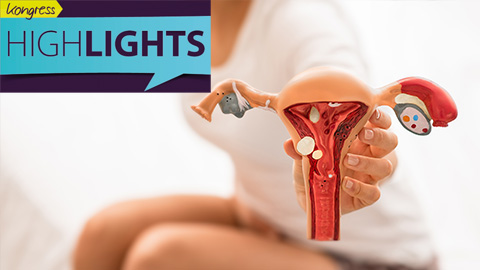 Frau hält Uterusmodell in die Kamera