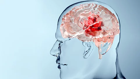 Human brain nervous system anatomy, neural cancer, Sebaceous bulb, brain cancer tumor malignant cells growth and spreading, Meningioma, neurological disease, metastasis cancerous, cerebrum, 3d render