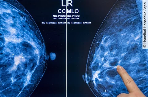 urn:newsml:dpa.com:20090101:250708-935-701351