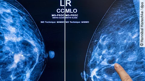 urn:newsml:dpa.com:20090101:250708-935-701351