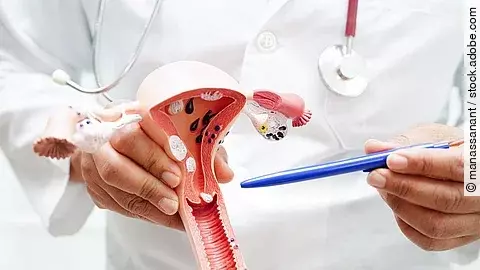 Uterus, doctor holding anatomy model for study diagnosis and treatment in hospital.