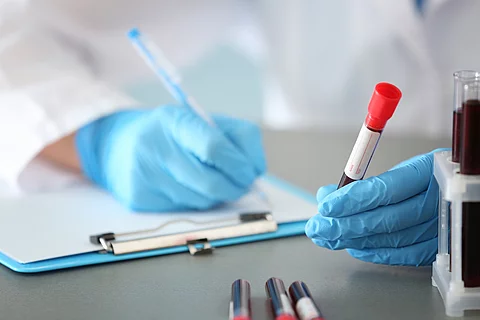Woman working with blood sample in test tube at table Bluttest