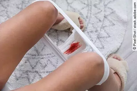 Menstruationsslip: Trotz Fortschritten in der Aufklärung bleibt die Menstruation für viele Frauen ein Tabu-Thema