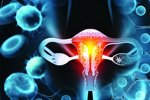 Female reproductive system diseases. Uterus cancer and endometri