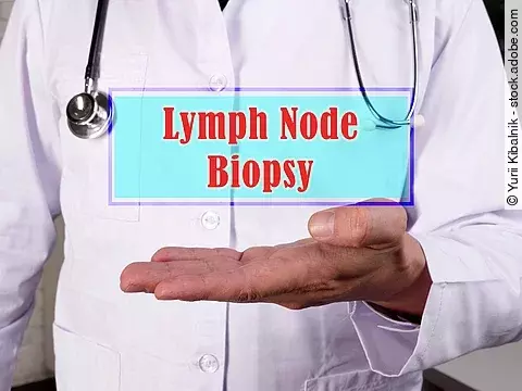 Medical concept meaning Lymph Node Biopsy with sign on the piece of paper.
