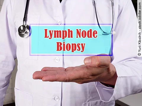 Medical concept meaning Lymph Node Biopsy with sign on the piece of paper.