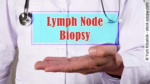 Medical concept meaning Lymph Node Biopsy with sign on the piece of paper.