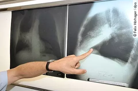 urn:newsml:dpa.com:20090101:260203-935-1124675