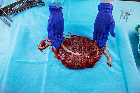 childbirth, placenta closeup, midwifery