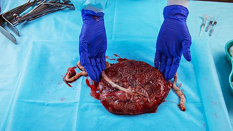 childbirth, placenta closeup, midwifery