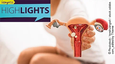 Frau hält Uterusmodell in die Kamera