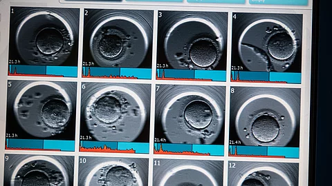 urn:newsml:dpa.com:20090101:250531-935-622561 Ultraschallaufnahme nach einer Fehlgeburt: Ab der 13. Schwangerschaftswoche erhalten Frauen nach einer Fehlgeburt nun erstmals gesetzlichen Mutterschutz.