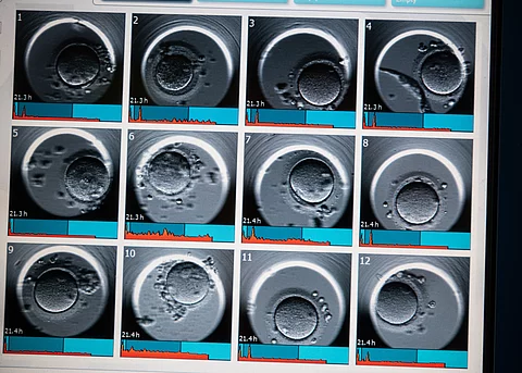 Ultraschallaufnahme nach einer Fehlgeburt:  Ab der 13. Schwangerschaftswoche erhalten Frauen nach einer Fehlgeburt nun erstmals gesetzlichen Mutterschutz.
