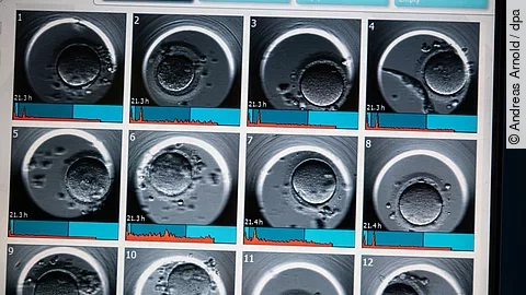 Ultraschallaufnahme nach einer Fehlgeburt:  Ab der 13. Schwangerschaftswoche erhalten Frauen nach einer Fehlgeburt nun erstmals gesetzlichen Mutterschutz.