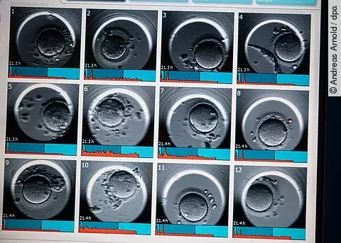 Ultraschallaufnahme nach einer Fehlgeburt:  Ab der 13. Schwangerschaftswoche erhalten Frauen nach einer Fehlgeburt nun erstmals gesetzlichen Mutterschutz.