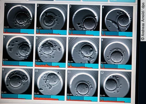 Ultraschallaufnahme nach einer Fehlgeburt:  Ab der 13. Schwangerschaftswoche erhalten Frauen nach einer Fehlgeburt nun erstmals gesetzlichen Mutterschutz.