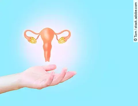 Gebärmutter: Linzagolix: Neues Anwendungsgebiet Endometriose