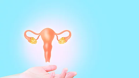 Female reproductive health concept. endometriosis, PCOS, gynecol