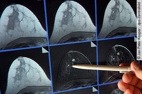 urn:newsml:dpa.com:20090101:251107-935-940073