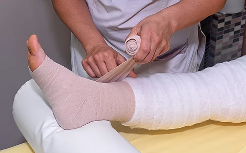 Lymphedema management: Wrapping leg using multilayer bandages to control Lymphedema. Part of complete decongestive therapy (cdt) and manual lymphatic drainage (MLD) Lymphedema management: Wrapping leg using multilayer bandages to control Lymphedema. Part of complete decongestive therapy (cdt) and manual lymphatic drainage (MLD)