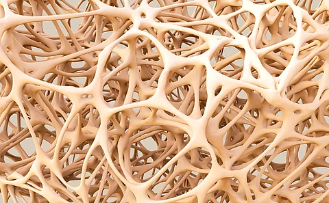 abstract shapes, bone structure