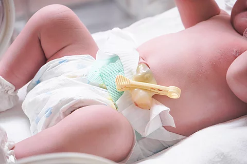 Newborn baby girl inside incubator in hospital post delivery roo