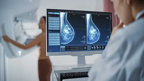 Eine Radiologin sitzt vor mehreren Monitoren in einem Krankenhaus und betrachtet Mammografie‑Aufnahmen.