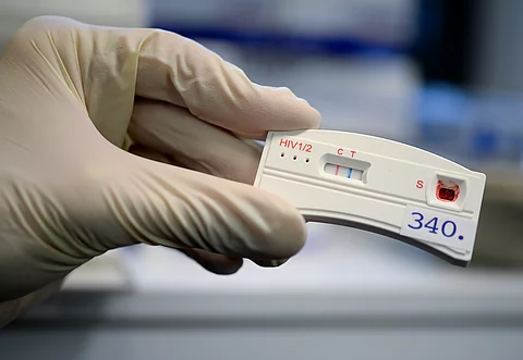 Europa verfehlt Teilziele im Kampf gegen HIV und Hepatitis Europa verfehlt Teilziele im Kampf gegen HIV und Hepatitis