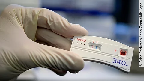 Europa verfehlt Teilziele im Kampf gegen HIV und Hepatitis