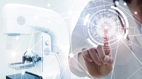 Mammografiegerät und angedeutete künstliche Intelligenz