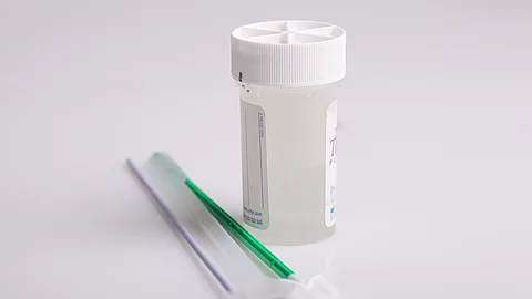 Zytologie, Zellabstrich, HPV
